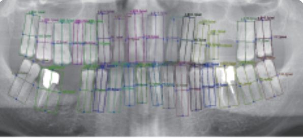 X-Ray